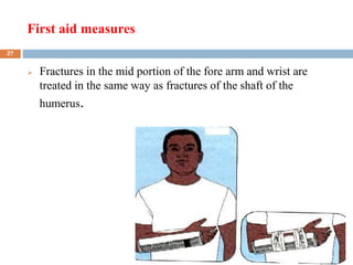 First aid measures
2/7/2023
 Fractures in the mid portion of the fore arm and wrist are
treated in the same way as fractures of the shaft of the
humerus.
27
 
