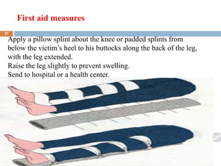 First aid measures
2/7/2023
Apply a pillow splint about the knee or padded splints from
below the victim’s heel to his buttocks along the back of the leg,
with the leg extended.
Raise the leg slightly to prevent swelling.
Send to hospital or a health center.
37
 