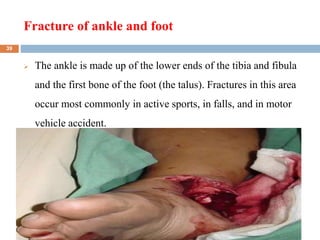 Fracture of ankle and foot
2/7/2023
 The ankle is made up of the lower ends of the tibia and fibula
and the first bone of the foot (the talus). Fractures in this area
occur most commonly in active sports, in falls, and in motor
vehicle accident.
39
 