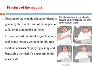 Fracture of the scapula
2/7/2023
 Fracture of the scapula (shoulder blade) is
generally the direct result of the impact o...