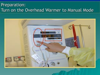 Preparation:
Turn on the Overhead Warmer to Manual Mode
 