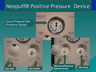 Neopuff® Positive Pressure Device

Circuit Pressure Dial
(Pressure Gauge)




                                MaximumPressure
                   Gas Outlet   Release Knob      PIP Knob
Gas Inlet
 