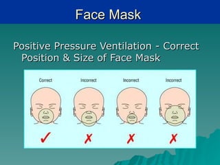 Face Mask

Positive Pressure Ventilation - Correct
 Position & Size of Face Mask
 