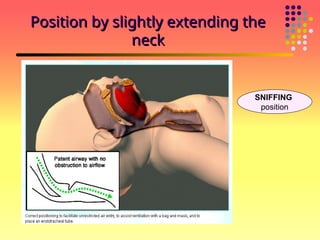 Initial steps NRP initial steps of resuscitation | PPT