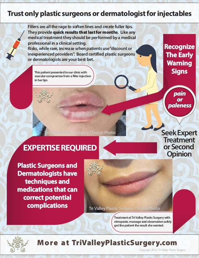 Injectable vascular compromise