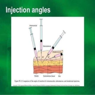 Serich Injection Injection 1 | PPTX