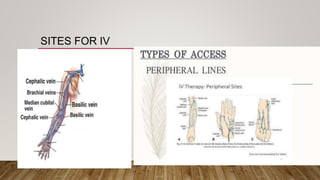 SITES FOR IV
 