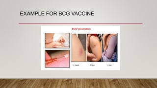 EXAMPLE FOR BCG VACCINE
 
