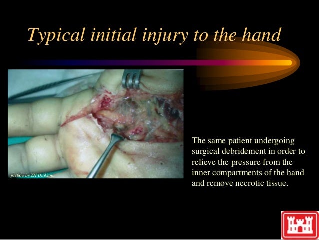 fluid injectioninjurytraining