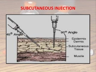 Sub Conj Injection Injections | PPTX