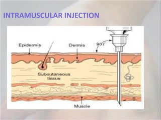 Intramuscular Injection 577 Injections | PPTX