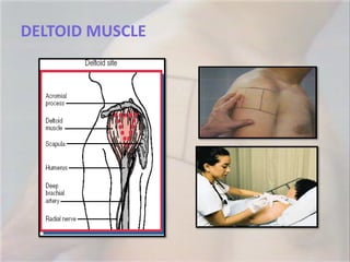 DELTOID MUSCLE
 