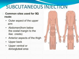 Injections | PPTX