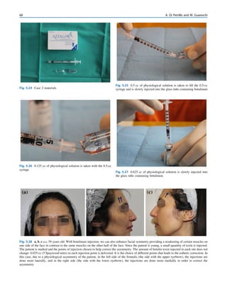 Injections in Aesthetic Medicine_ Atlas of Full-face and Full-body ...