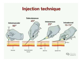 injectiontechnique.pptx