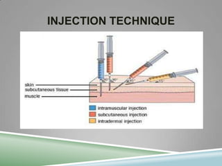 Injection Technique | PPTX
