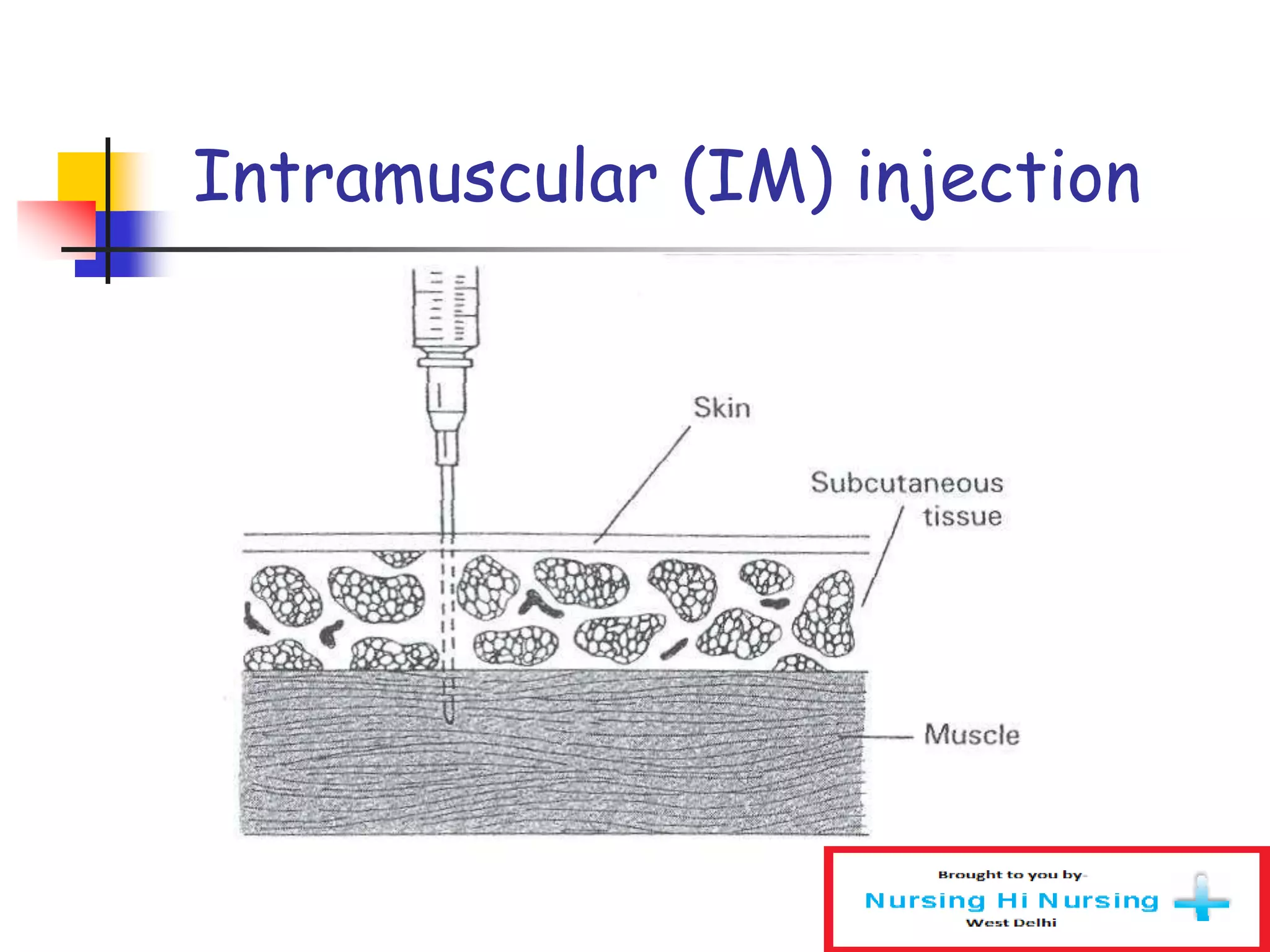 Intramuscular (IM) injection
 