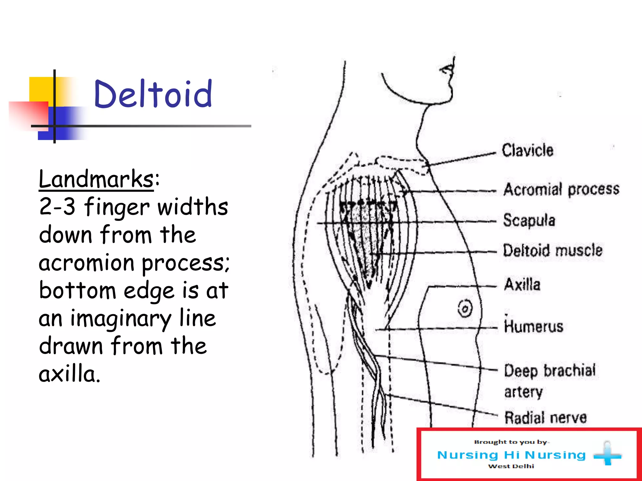 Landmarks:
2-3 finger widths
down from the
acromion process;
bottom edge is at
an imaginary line
drawn from the
axilla.
Deltoid
 