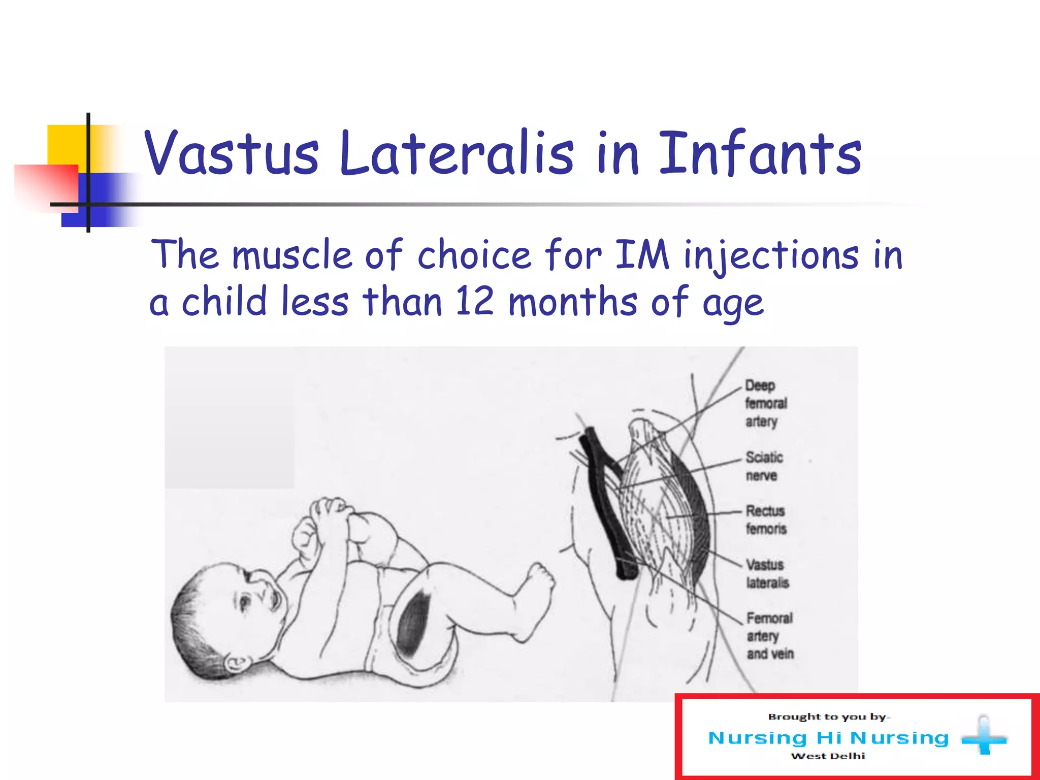 The muscle of choice for IM injections in
a child less than 12 months of age
Vastus Lateralis in Infants
 