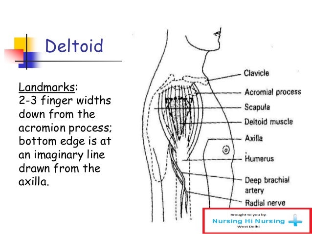 🎉 Deltoid injection technique. Subacromial Bursa Injection ...