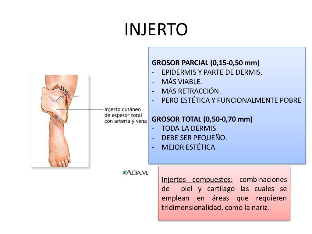 Injerto de piel completo Injerto de piel completo