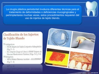 La cirugía plástica periodontal involucra diferentes técnicas para el tratamiento de deformidades o deficiencias mucogingi...