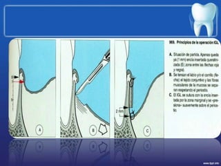 bolsabase personalised