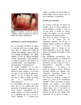 Figura 5: Incisión a nivel de mucosa
vestibular, nótese la distancia de 2mm por
debajo de la unión mucogingival.
Obtención y recolección del injerto.
Para la recolección del injerto de mentón
es necesario saber que se puede utilizar
otras clases de injertos para evitar un
segundo acto quirúrgico, pero a pesar de
los adelantos tecnológicos de hueso
suplente, el uso de injertos autógenos
continúa representando el gold estándar26
en cirugía reconstructiva oral debido a su
osteoinductividad, osteoconductividad, y
sus propiedades no inmunogenicas27.
La sínfisis mandibular es un área
donadora intraoral muy común para los
injertos de hueso autógeno y se ha usado
con éxito en una variedad de aplicaciones
clínicas28, ya que el injerto de mentón
tiene hueso cortical y medular necesarios
para la osteoinducción y
osteoconducción29.
Las características del injerto de mentón
hacen que sea un material ideal para
incrementar la dimensión transversal de la
cresta alveolar, especialmente en el
maxilar superior y en sectores posteriores
de la mandíbula, más aún si se van a
colocar implantes 30 31; además para
obtener y recolectar este tipo de injerto se
pueden utilizar diversas técnicas como las
que se mencionan a continuación:
Técnicas de recolección
Las técnicas recolección del injerto son
variadas, desde la clásica utilización de
fresas quirúrgicas y cinceles 32 (Fig. 7),
las que tienen la ventaja de obtener
bloques más amplios y nos van a permitir
reconstrucción de defectos grandes.
Otra forma de obtener el injerto es a
través de las trefinas que son
instrumentos giratorios, con las que se
obtienen bloques circulares de diferentes
diámetros 33 34 35 (Fig. 8 y 9). Estos
instrumentos tienen la ventaja de ser
menos traumáticos y tal vez más rápidos,
pero con la limitación del tamaño y forma
del bloque.
Los instrumentos piezoeléctricos (Fig.
10), son otra alternativa de obtención del
injerto en bloque, además que se ha
demostrado una gran ventaja en el intra y
postoperatorio, generando menos
complicaciones36 37 en relación a la
técnica de fresado y cinceles. Debemos
mencionar también que mediante estos
instrumentos obtendríamos bloques más
grandes en relación a las trefinas.
Otra forma de recolectar el injerto de
mentón es a través de los denominados
autochips o fresas recolectoras de hueso
triturado, muy similares a las trefinas
(Fig.11). Es una forma convencional de
obtener injerto óseo, el cual podría ser
utilizado en diversas situaciones como la
elevación de piso de seno maxilar, como
coadyuvante de los injertos en bloque, o
 