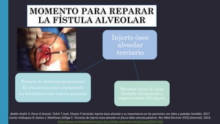 Injerto Oseo Alveolar | PPTX