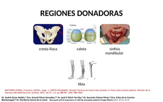 injerto oseos alveolares en el manejo de LPH.pptx