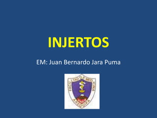 INJERTOS
EM: Juan Bernardo Jara Puma
 