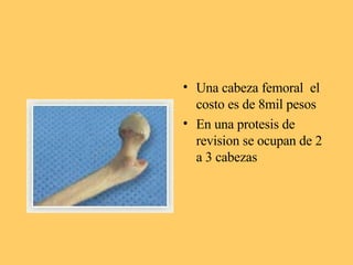 <ul><li>Una cabeza femoral  el costo es de 8mil pesos </li></ul><ul><li>En una protesis de revision se ocupan de 2 a 3 cab...