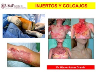 INJERTOS Y COLGAJOS
Dr. Héctor Juárez Granda
 