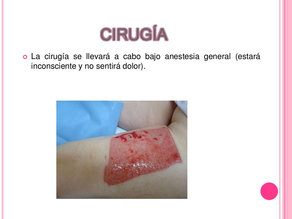 Injertos de piel Injertos de piel