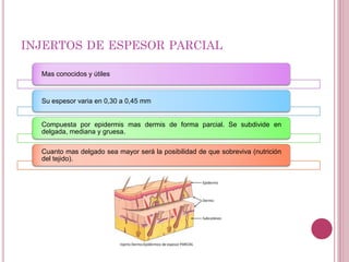 INJERTOS DE ESPESOR PARCIAL
Mas conocidos y útiles
Su espesor varia en 0,30 a 0,45 mm
Compuesta por epidermis mas dermis de forma parcial. Se subdivide en
delgada, mediana y gruesa.
Cuanto mas delgado sea mayor será la posibilidad de que sobreviva (nutrición
del tejido).
 