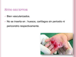 SITIO RECEPTOR
 Bien vascularizados.
 No se inserta en : huesos, cartílagos sin periostio ni
pericondrio respectivamente.
 