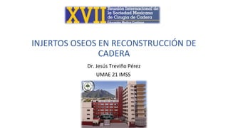 INJERTOS OSEOS EN RECONSTRUCCIÓN DE
CADERA
Dr. Jesús Treviño Pérez
UMAE 21 IMSS
 
