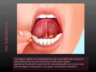 Vantagens: Nesta via medicamentos são colocados sob a língua e
absorvidos pela mucosa oral.Estas medicações,agem
rapidamente,devido á abundante vascularização da mucosa oral.
Desvantagens: Absorção é, em geral, incompleta e errática.

 