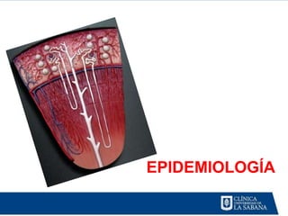 EPIDEMIOLOGÍA
 