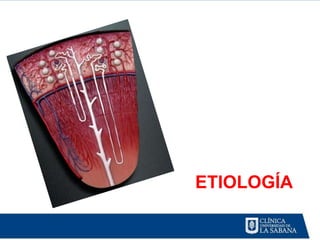 ETIOLOGÍA
 