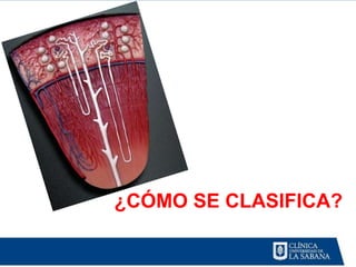 ¿CÓMO SE CLASIFICA?
 