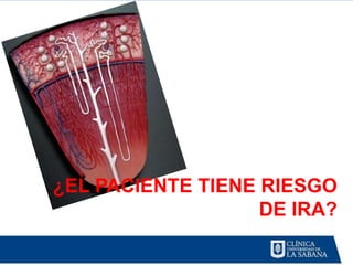 ¿EL PACIENTE TIENE RIESGO
                   DE IRA?
 