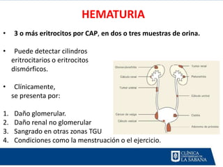 HEMATURIA
•     3 o más eritrocitos por CAP, en dos o tres muestras de orina.

•     Puede detectar cilindros
     eritrocitarios o eritrocitos
     dismórficos.

•     Clínicamente,
     se presenta por:

1.    Daño glomerular.
2.    Daño renal no glomerular
3.    Sangrado en otras zonas TGU
4.    Condiciones como la menstruación o el ejercicio.
 