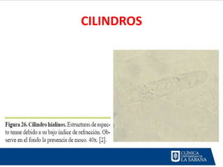 CILINDROS
 