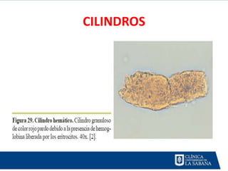 CILINDROS
 
