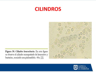 CILINDROS
 
