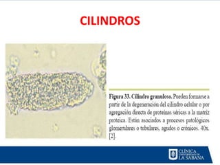 CILINDROS
 