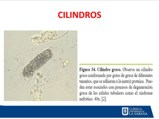 CILINDROS
 