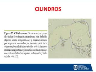 CILINDROS
 