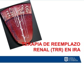 TERAPIA DE REEMPLAZO
    RENAL (TRR) EN IRA
 